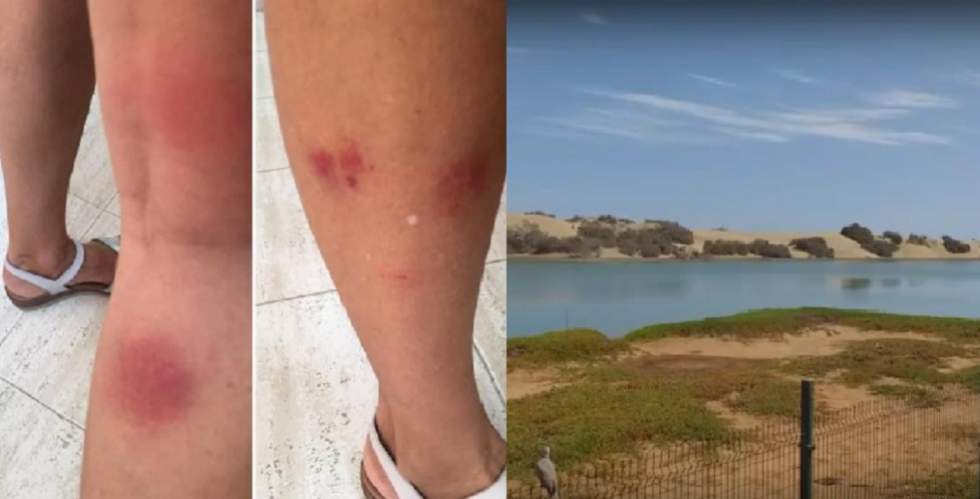 Siguen Picaduras de Mosquitos Marismas en Maspalomas